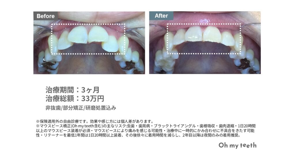 画像に alt 属性が指定されていません。ファイル名: 3-1024x538.jpg